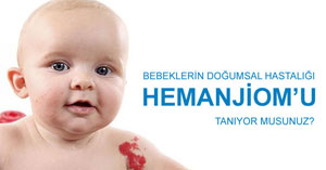 Hemanjiom nedir