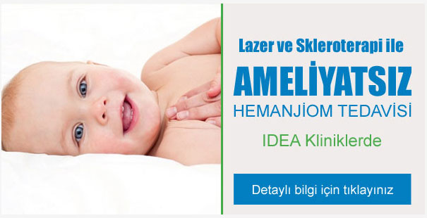 Hemanjiom tedavi merkezi